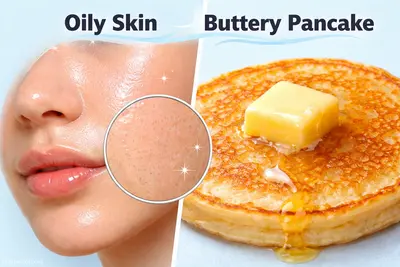 Карточка жирной кожи Визуальная ассоциация жирной кожи - блин с маслом на светло-голубом фо